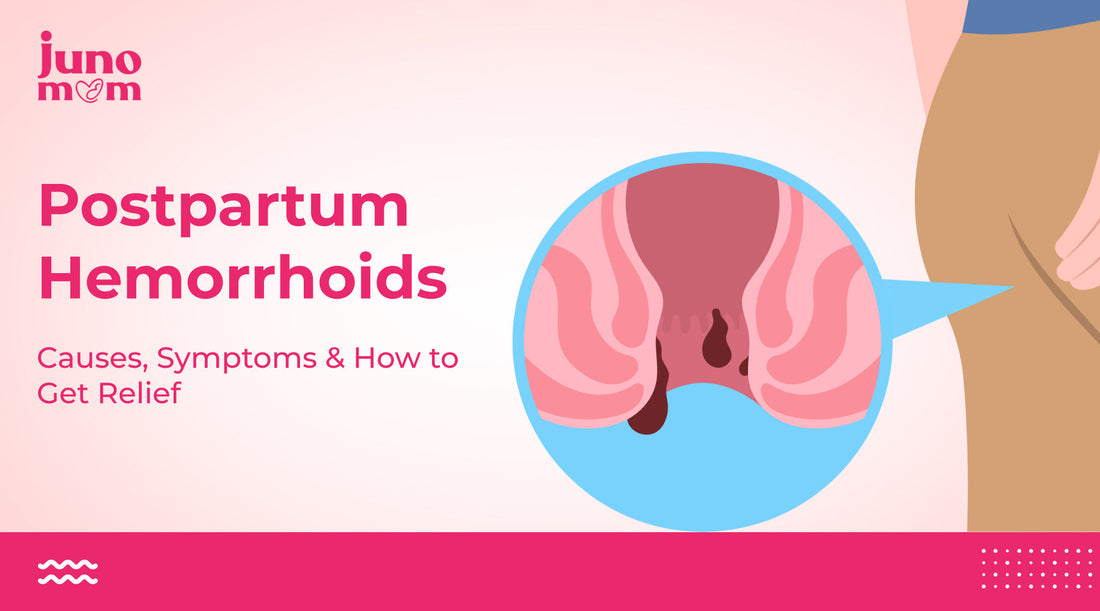 Postpartum Hemorrhoids: Causes, Symptoms, & How to Get Relief