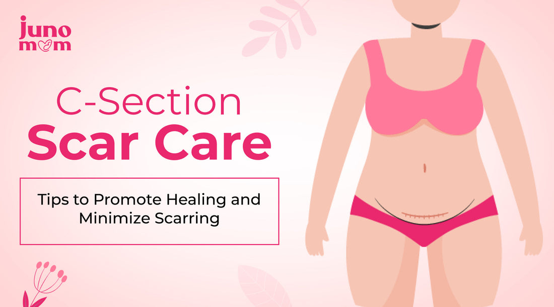 C-Section Scar Care: Tips to Promote Healing and Minimize Scarring