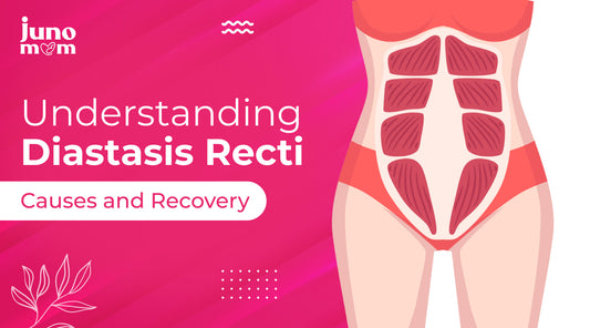 What is Diastasis Recti and How to Treat It?