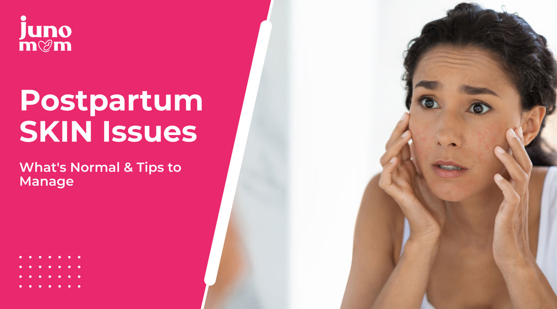 Postpartum Skin Issues: What's Normal & Tips to Manage